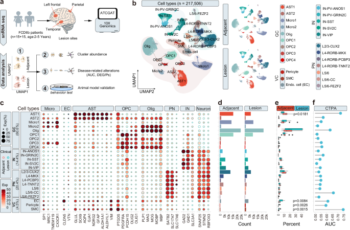 Fig. 1: Overview of cell types in the Neocortex of FCDIIb Patients.