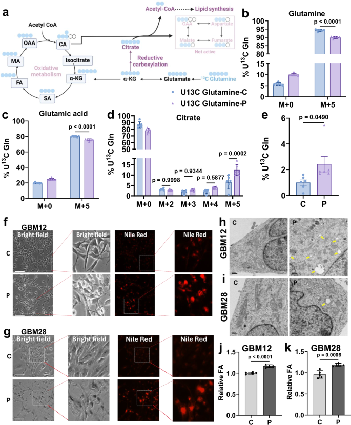 Fig. 4: A reductive pathway of glutamine metabolism in GBM cells following oHSV infection.