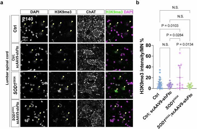 Fig. 10: An increase of H3K9me3 is observed&nbsp;in MNs of SOD1G93A and is reduced after scAAV9-shFto treatment.