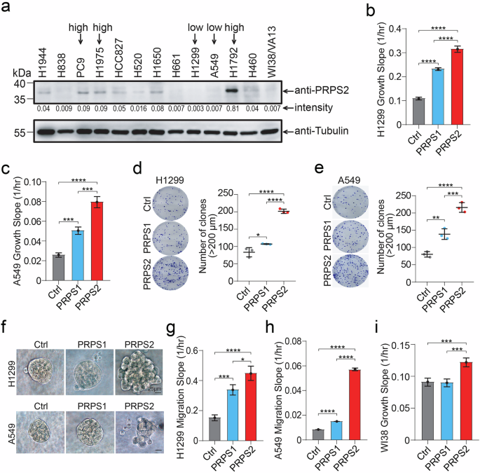 Fig. 2: Ectopic expression of PRPS2 promotes lung cancer and fibroblast cell proliferation and migration.