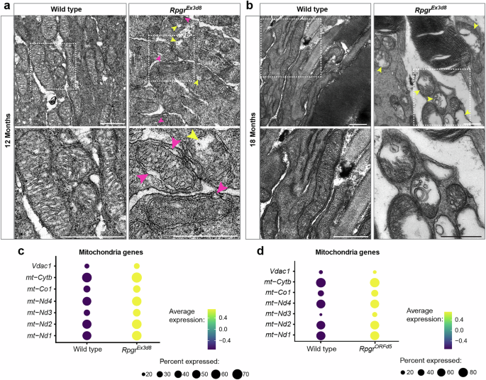 Fig. 4: Rpgr-mutant photoreceptors have abnormal mitochondrial morphology, indicative of mitochondrial damage.