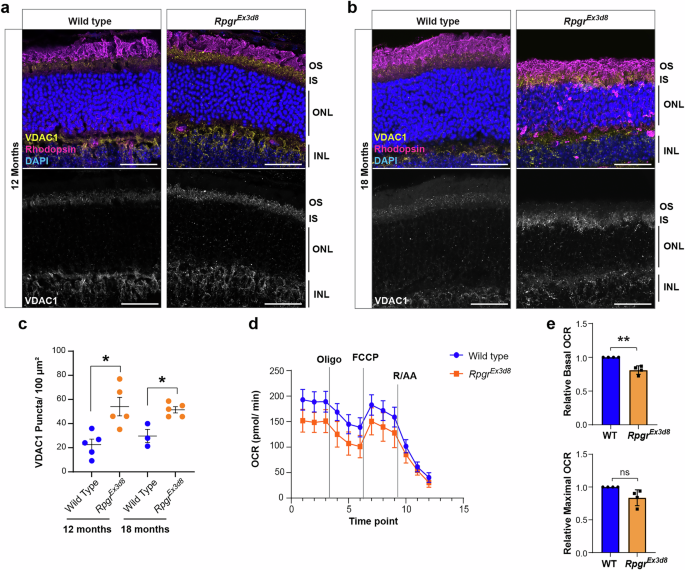 Fig. 5: Mitochondrial stress develops in Rpgr mutant photoreceptors.