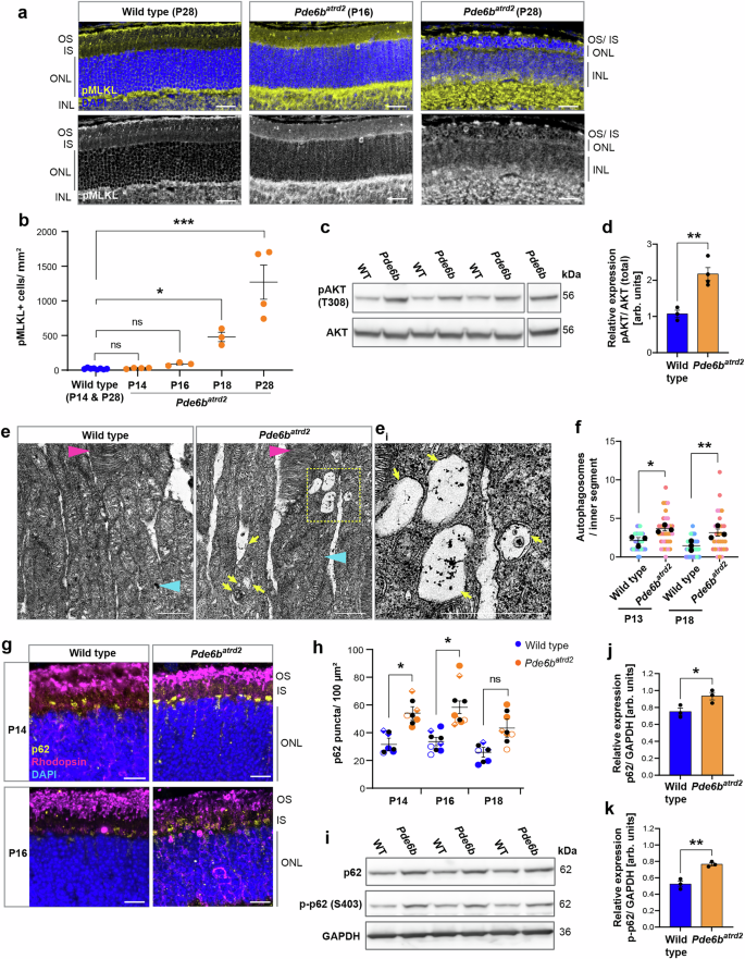 Fig. 7: Necroptosis and autophagy dysregulation are important cell death mechanisms in the Pde6batrd2 mouse model of RP.
