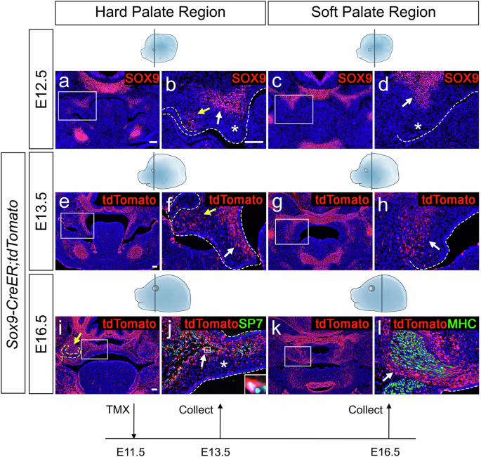 Fig. 6: In vivo characterization of SOX9+ mesenchymal progenitors in the palatal region.