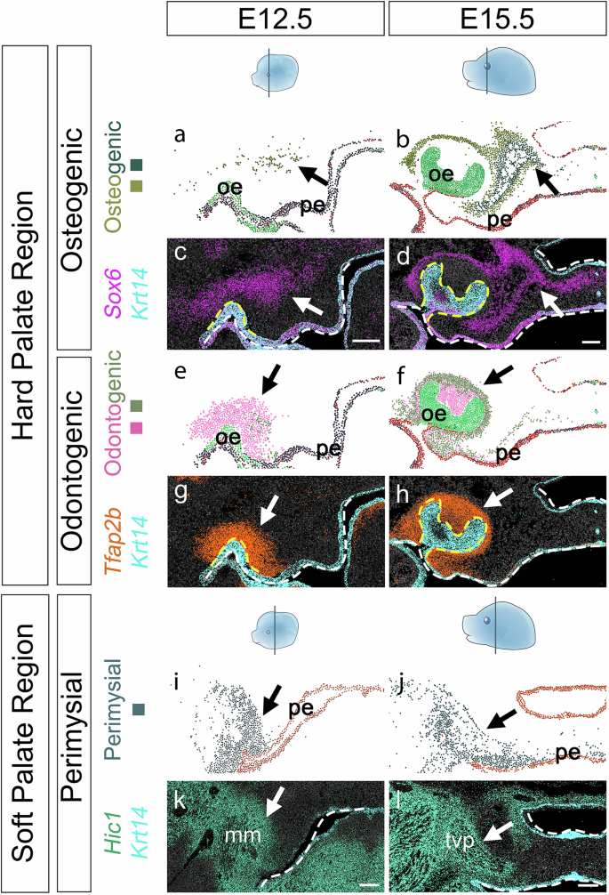Fig. 7: SeqFISH analysis reveals expression patterns of osteogenic, odontogenic, and perimysial lineage markers from E12.5 to E15.5.