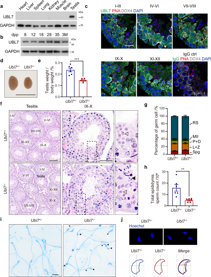 Fig. 1: Loss of UBL7 leads to sperm malformation and male sterility in mice.