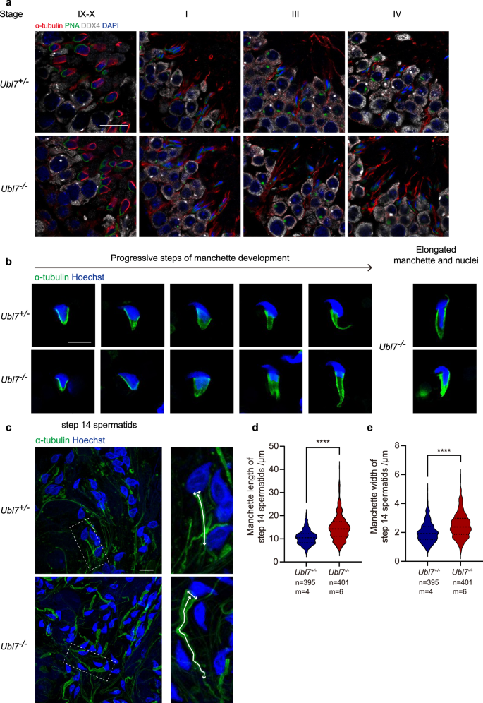 Fig. 2: Loss of UBL7 leads to manchette defects.