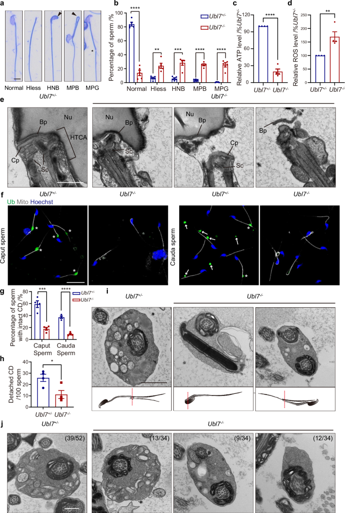 Fig. 3: Defects of HTCA, annulus and CDs in Ubl7−/− sperm.