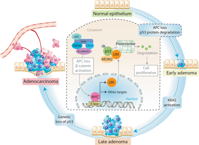Fig. 10: A revised model for CRC molecular progression.