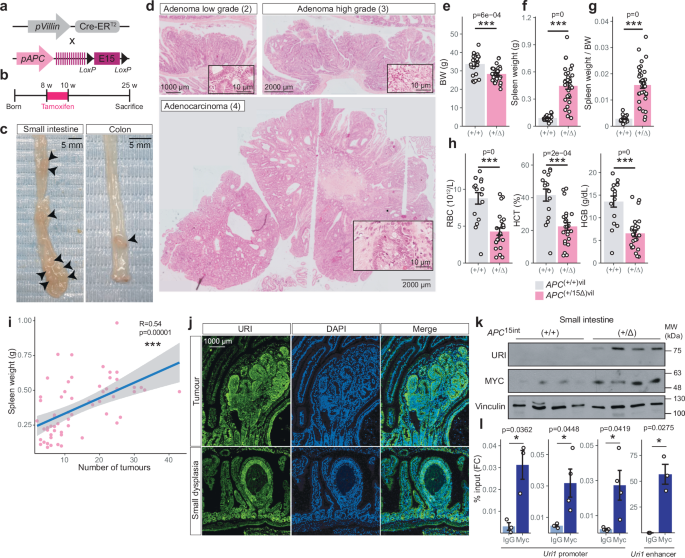 Fig. 3: APC loss induces CRC through MYC-mediated URI upregulation.