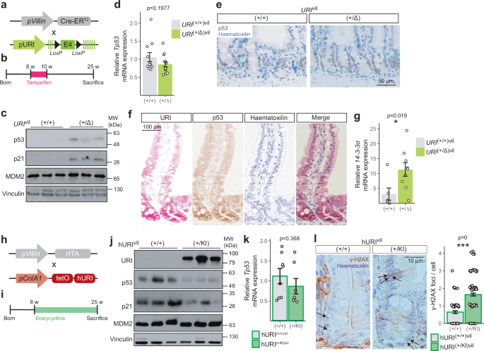 Fig. 4: Oncogenic URI modulates p53 protein stabilization.