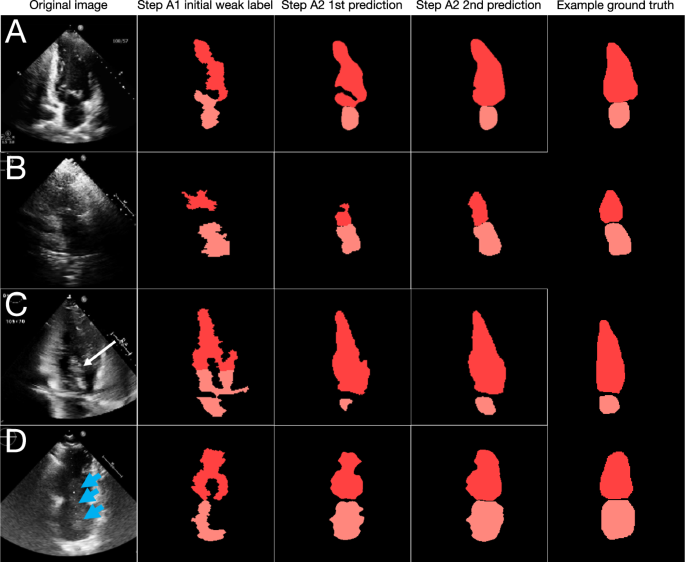 Self-supervised learning for label-free segmentation in cardiac ...