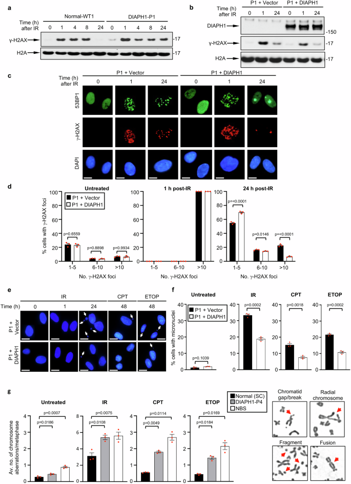 Fig. 2: Cells lacking DIAPH1 display an inability to repair DSBs.