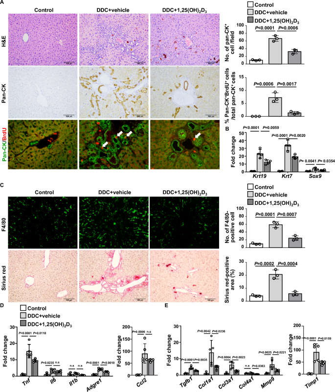 Fig. 2: 1,25(OH)2D3 treatment prevents DDC-induced ductular reaction and liver inflammation and fibrosis.