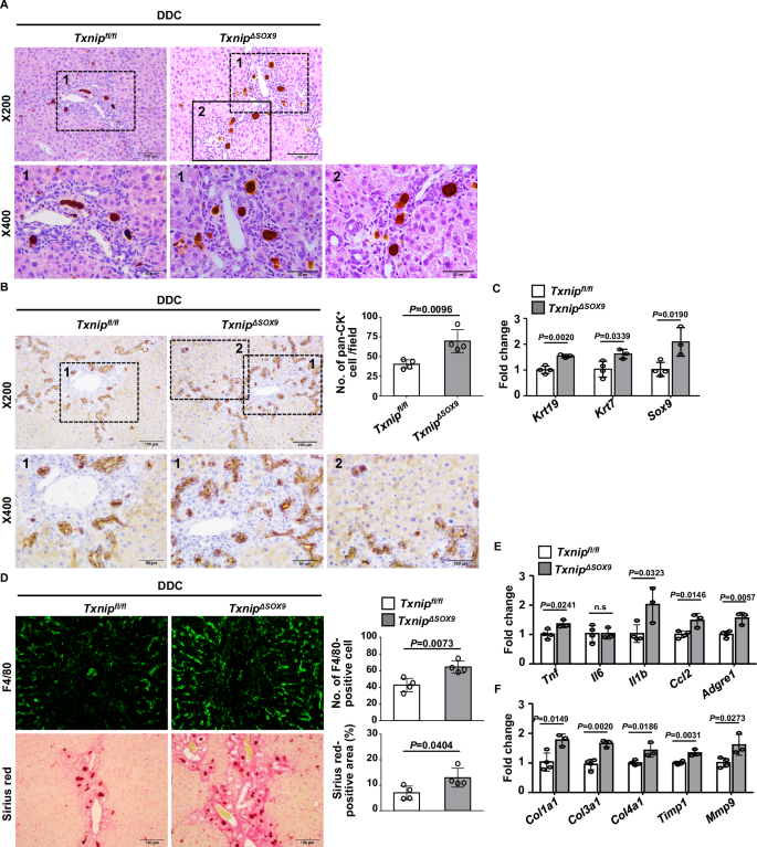 Fig. 4: Txnip deficiency in cholangiocytes exacerbates ductular reaction and liver inflammation and fibrosis in DDC-fed mice.