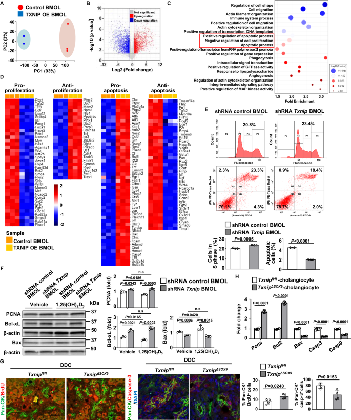 Fig. 5: TXNIP regulates cholangiocyte proliferation and apoptosis.