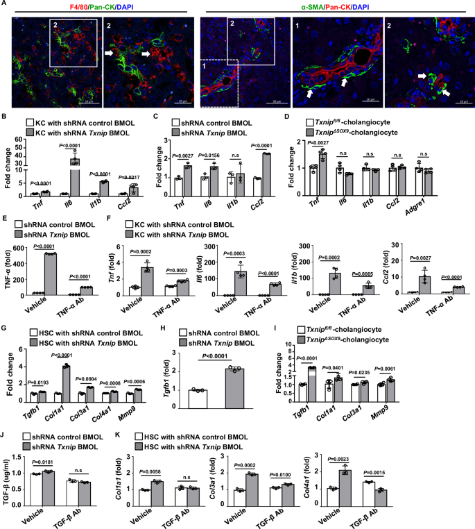 Fig. 6: Biliary TXNIP regulates secretion of pro-inflammatory and pro-fibrogenic mediators.