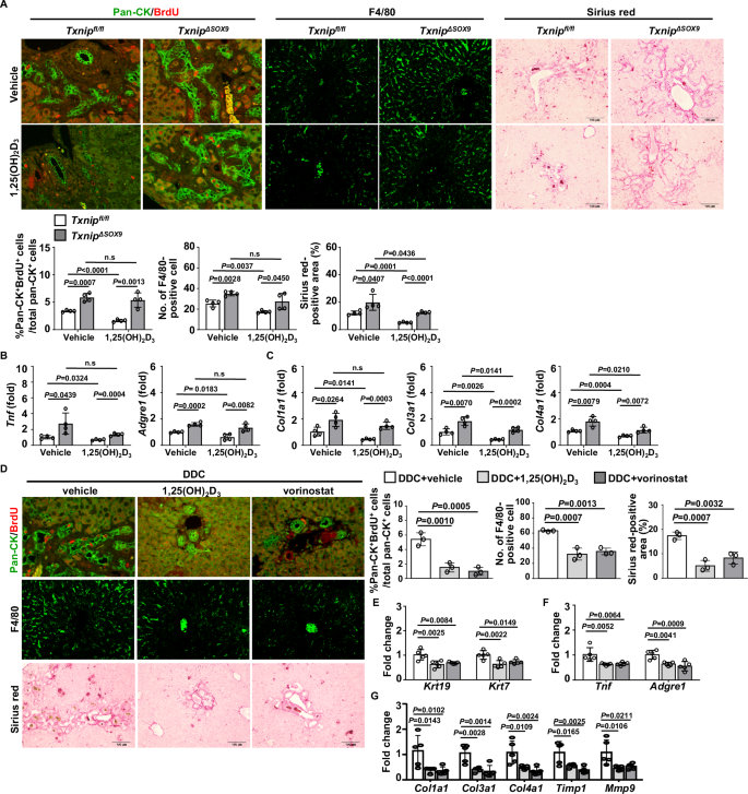 Fig. 7: Vitamin D attenuates DDC-induced ductular reaction and liver inflammation and fibrosis via TXNIP.