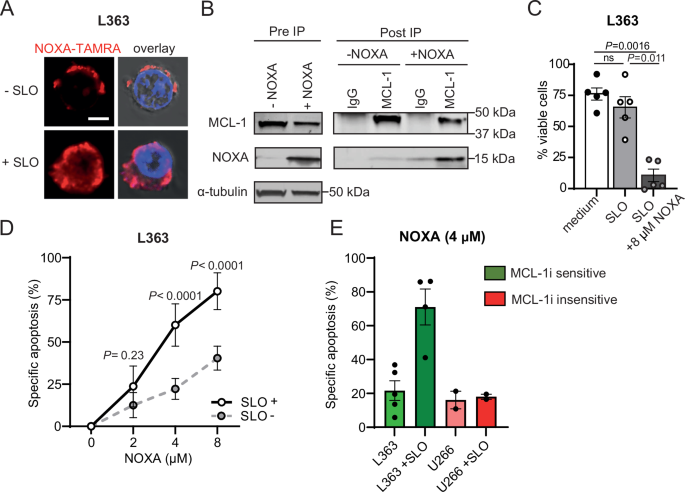 Fig. 2: Exogenous NOXA induces apoptosis in L363 cells.