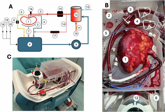 Fig. 2: Labelled diagram and images of the perfusion machine during use.