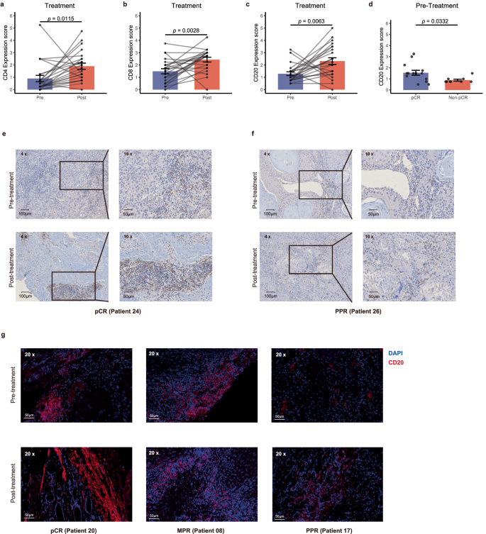 Fig. 5: Biomarker analyzes of treatment and pathological.