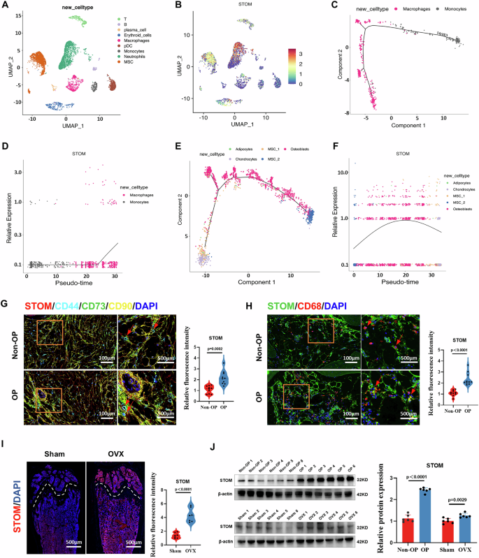Fig. 1: STOM expression is elevated in OP patients and OVX mice.