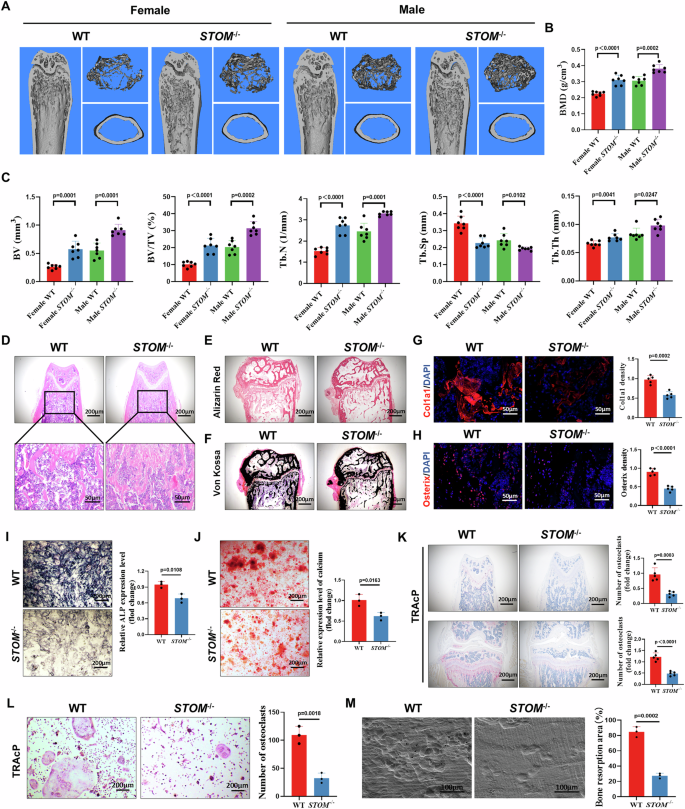 Fig. 2: Knockout of STOM affects osteoclastogenesis and osteogenesis in vivo.