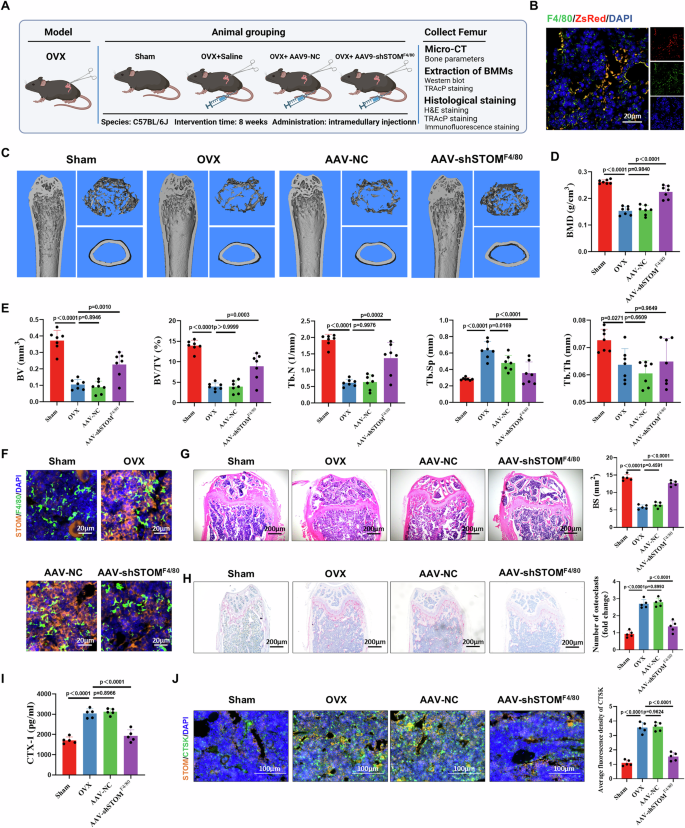 Fig. 7: Targeted knockdown of macrophage STOM alleviates OVX-mediated bone loss.