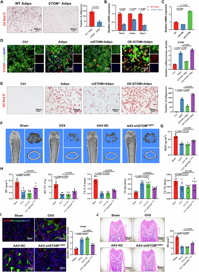 Fig. 8: Targeted knockdown of STOM in bone marrow adipocytes mitigates bone loss induced by OVX.