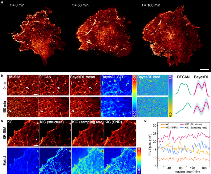 Fig. 4: BayesDL-SIM for long-term live-cell SR imaging.