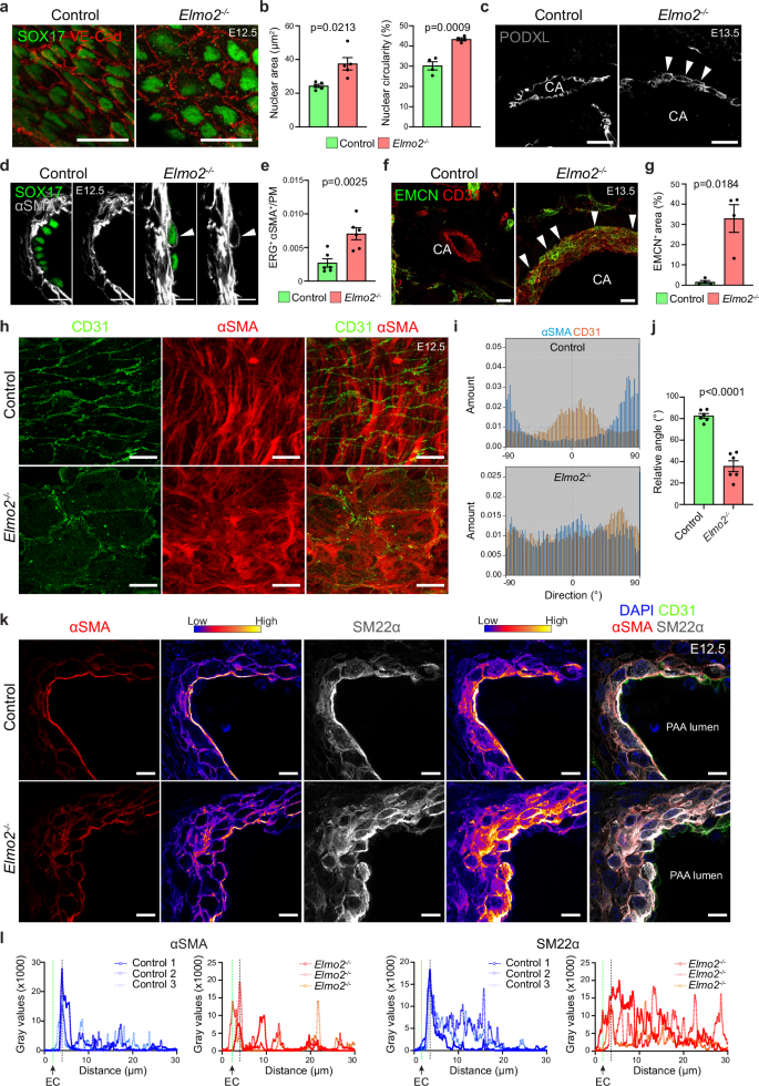 Fig. 2: Loss of Elmo2 causes defects in the third pharyngeal arch (3rd PAA) and carotid arteries (CAs).