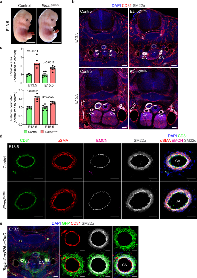Fig. 4: Deletion of Elmo2 using Tagln-Cre leads to subtle carotid artery dilation.