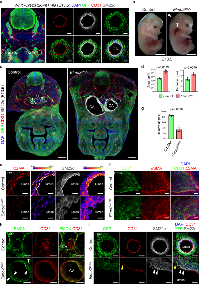 Fig. 5: Neural crest-specific deletion of Elmo2 phenocopies the global Elmo2 knockout.