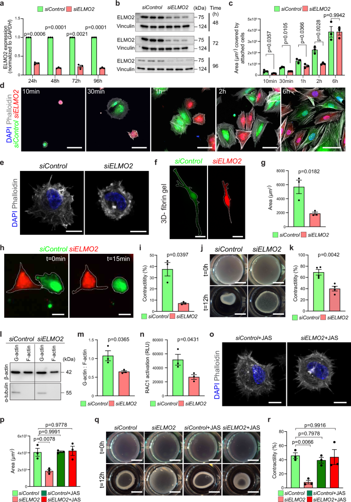 Fig. 6: Loss of ELMO2 in human brain vascular smooth muscle cells (HBVSMCs) impairs actin dynamics and contractility.
