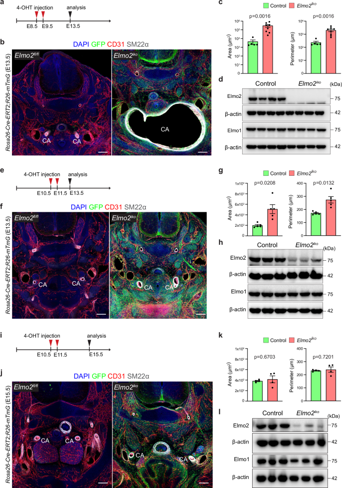 Fig. 7: Timing of global Elmo2 deletion controls aneurysm formation.