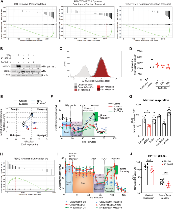 Fig. 1: ATMi impacts mitochondrial function and glutamine oxidation in HUVECs.