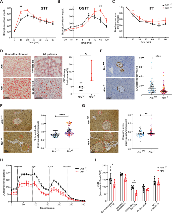 Fig. 6: ATM deficiency impairs pancreatic islet function leading to glucose intolerance and hepatic lipid accumulation.