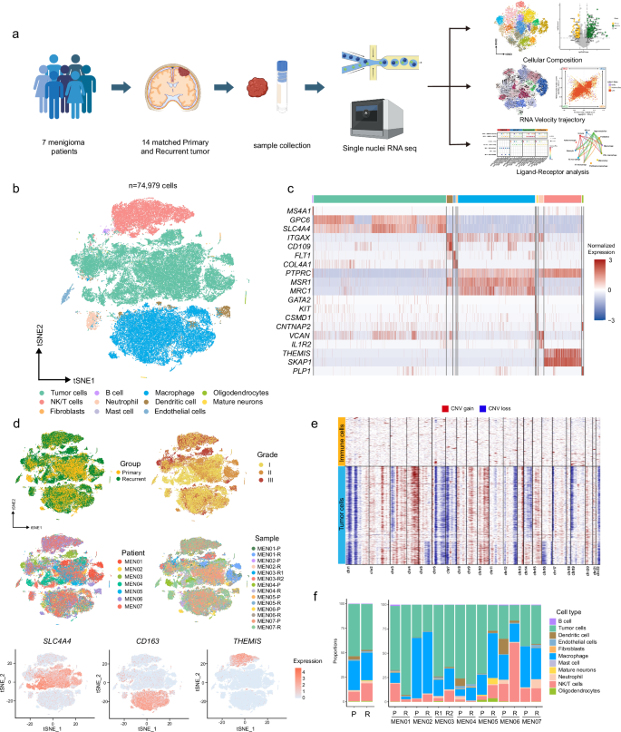 Fig. 1: A single-cell atlas of longitudinal meningioma.