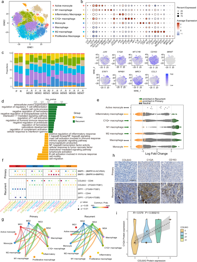 Fig. 4: TME analysis reveals cell-cell interaction between tumor cells and myeloid cells in longitudinal meningioma.
