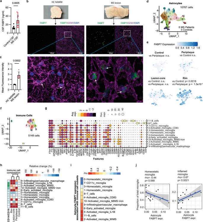 Fig. 6: FABP7 is increased in CSF of MS patients and highly expressed by astrocytes in MS lesions and is associated with inflammatory immune cell phenotypes in the brain.