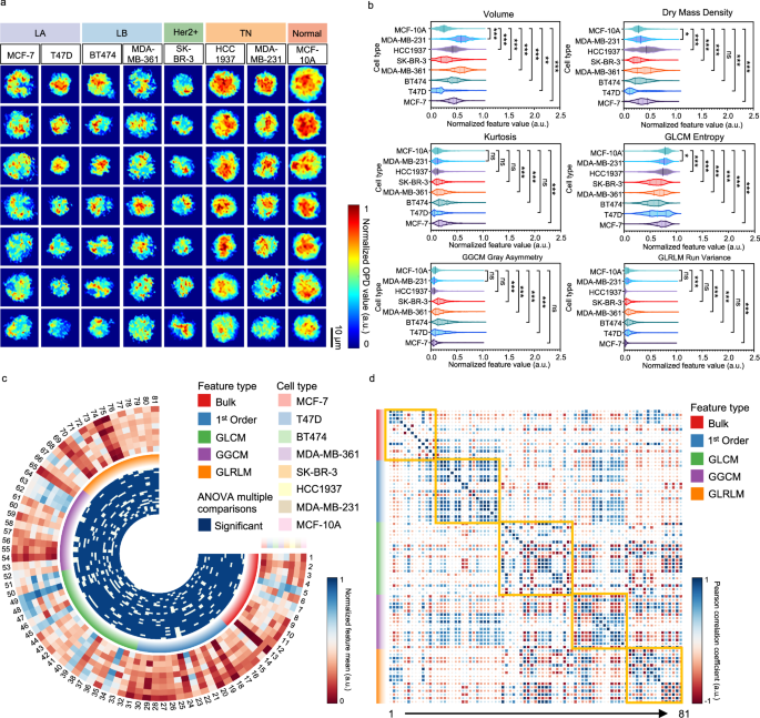 Fig. 5: Analysis of QPM phase features across breast cancer subtypes.