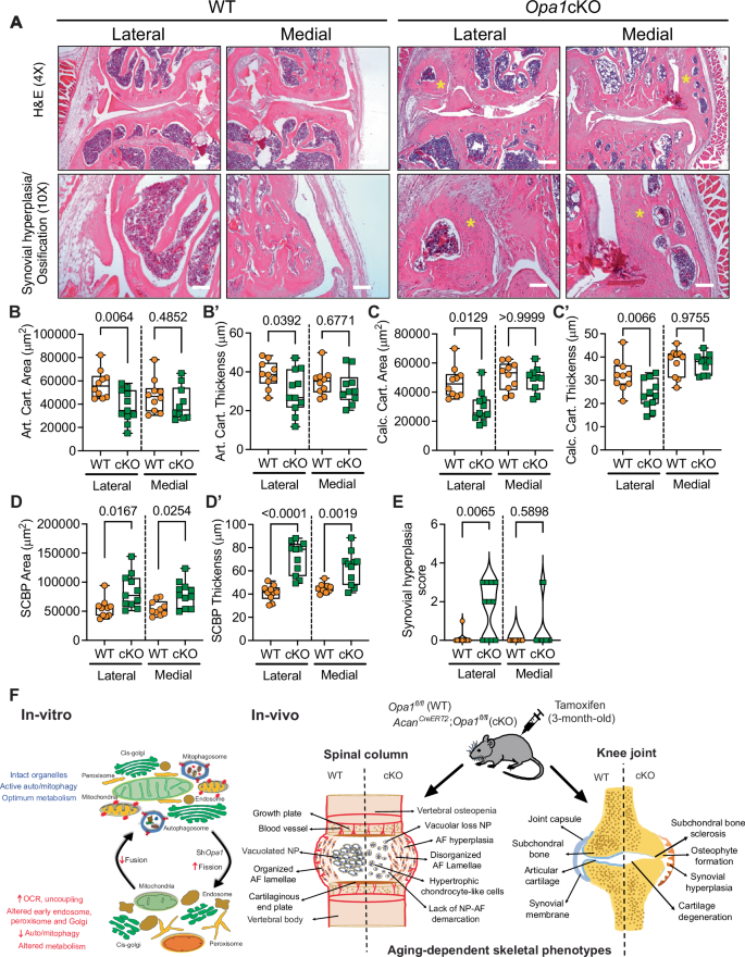 Fig. 10: Opa1cKO mice evidence synovial hyperplasia and morphological changes in articular cartilage and subchondral bone.