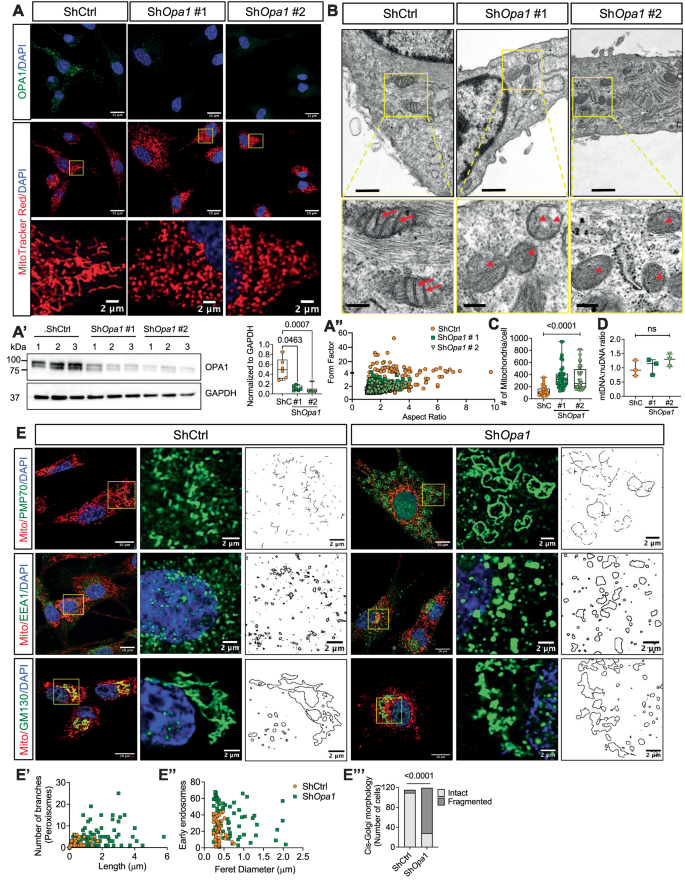 Fig. 1: OPA1 maintains mitochondrial and multiple organelle morphology in NP cells.