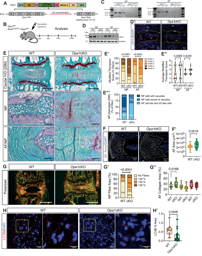 Fig. 6: Conditional deletion of Opa1 in IVD accelerates age-associated degeneration.