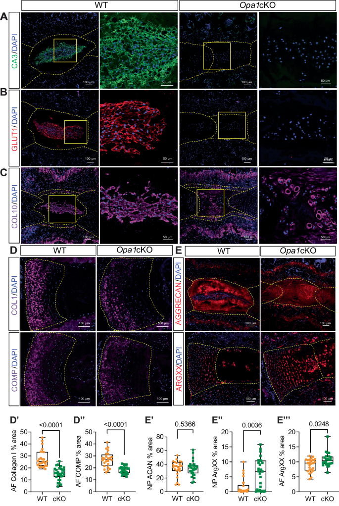 Fig. 7: The OPA1-deletion affects NP cell phenotype and alters the IVD matrix composition in mice.