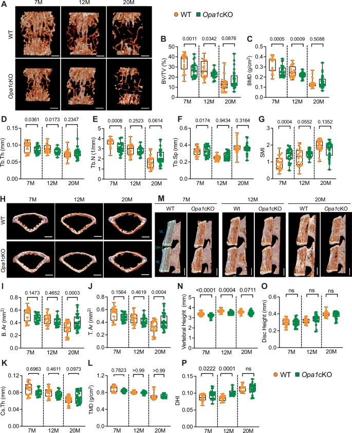 Fig. 8: Opa1cKO mice evidence alterations in vertebral bone health and disc height index.