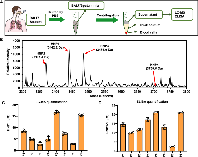 Fig. 4: HNPs are present in BALF/sputum samples from A. baumannii-infected pneumonia patients.