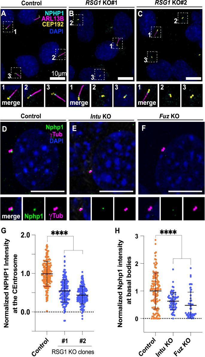 Fig. 10: CPLANE is required for normal recruitment of the transition zone to the basal body.