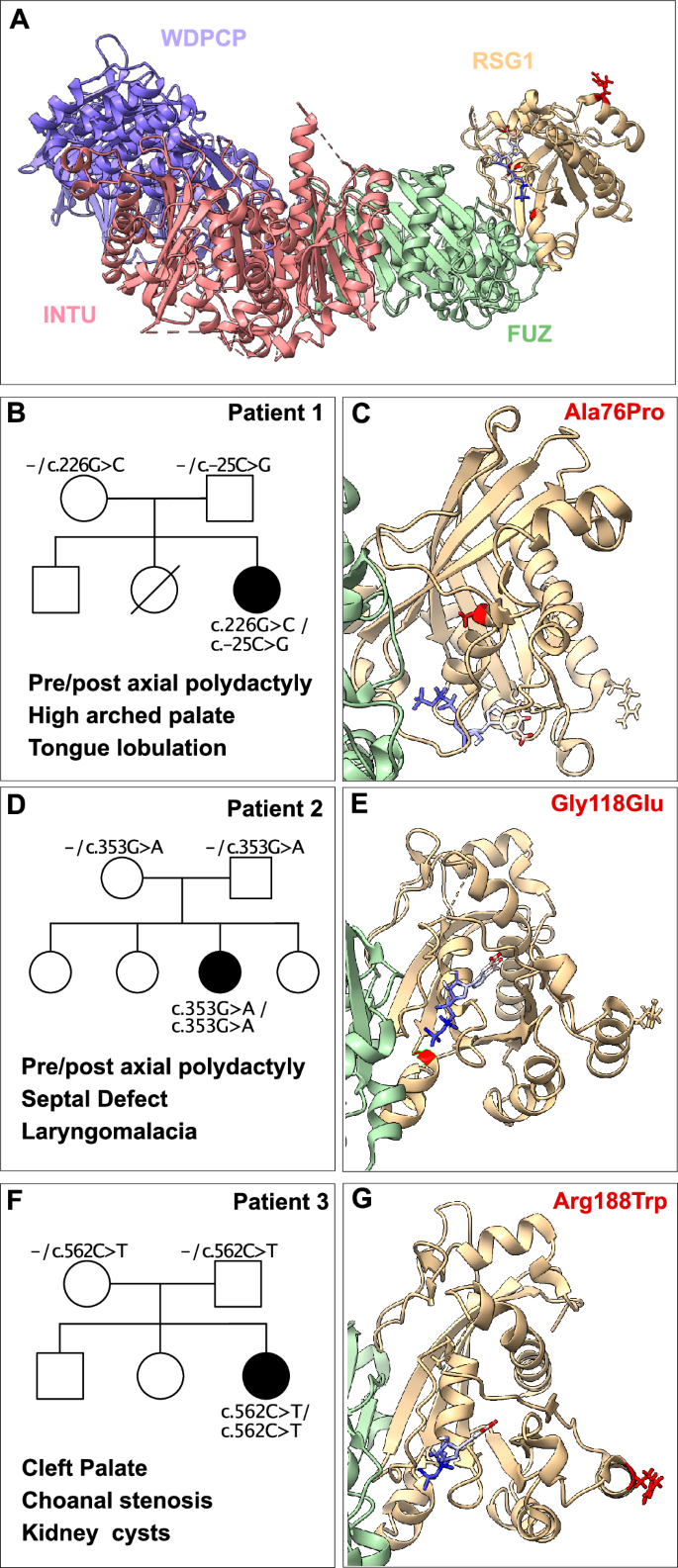 Fig. 1: Allelic variants of RSG1/CPLANE2 are associated with human ciliopathy.