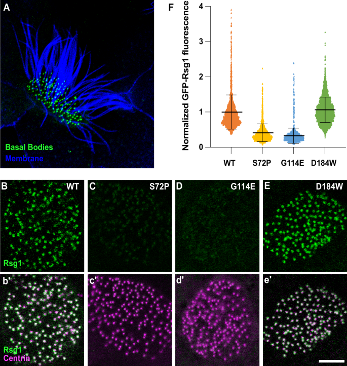 Fig. 2: Ciliopathy-associated alleles of RSG1 elicit distinct effects.